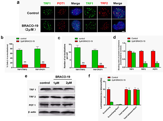 BRACO-19 specifically delocalizes TRF2 and POT1 from telomeres and induces telomeric 3&#x2032;-overhang degradation.