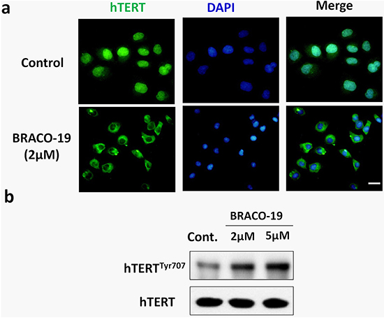 BRACO-19 treatment leads to a decrease of hTERT expression in the nucleus and translocation to cytoplasm.