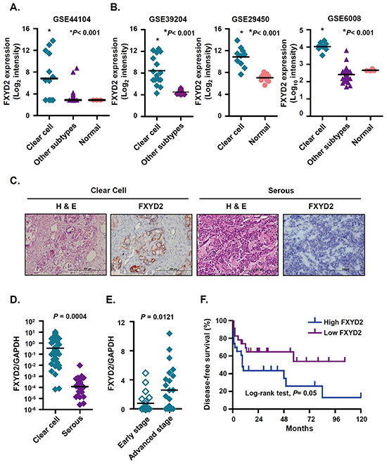 FXYD2 is highly expressed in ovarian clear cell cancer.