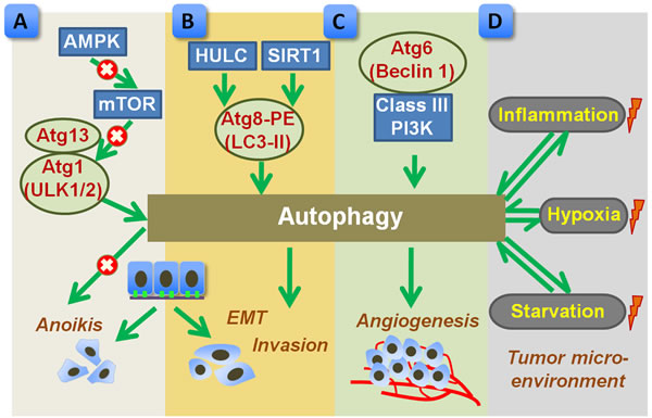 Proposed role of autophagy in promoting metastasis of gastric cancer.