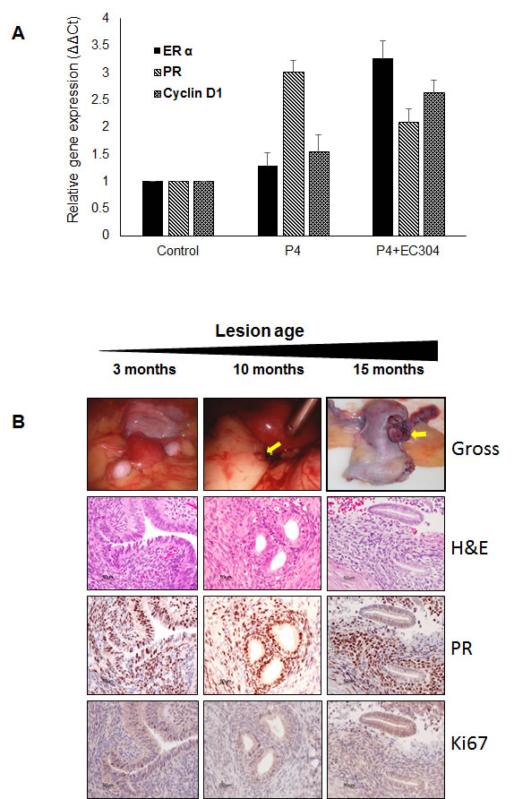 Gene expression of steroid receptors in the baboon endometrium treated with progesterone and antiprogestin (EC304).