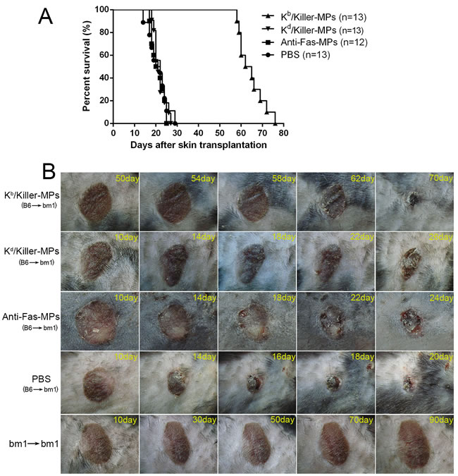 Killer MPs prolong alloskin graft survival in bm1 mice.
