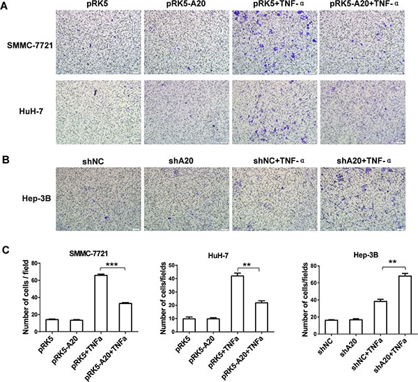 A20 inhibited migration of HCC cells induced by TNF-&#x03B1;.