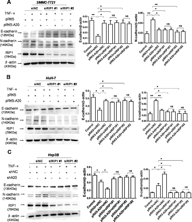 The inhibition of A20 in the EMT of HCC cells induced by TNF-&#x03B1; was dependent of RIP1.