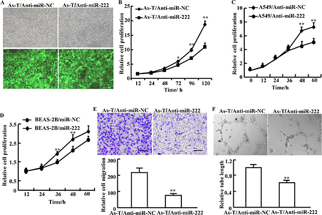 Treatment of cells using anti-miR-222 inhibitor decreases cell proliferation, migration, and tube formation.