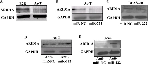 MiR-222 treatment inhibits ARID1A protein expression.