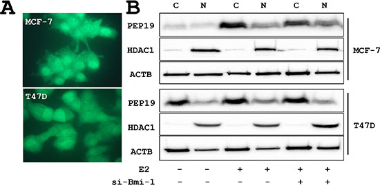 PCP4/PEP19 expression and subcellular localization.