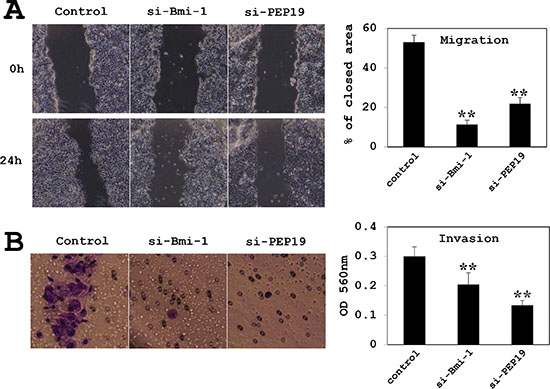 Effects of Bmi-1 and PCP4/PEP19 knockdown on cell migration and invasion in MCF-7 cells.