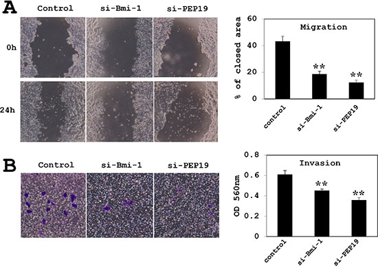 Effects of Bmi-1 and PCP4/PEP19 knockdown on cell migration and invasion in T47D cells.