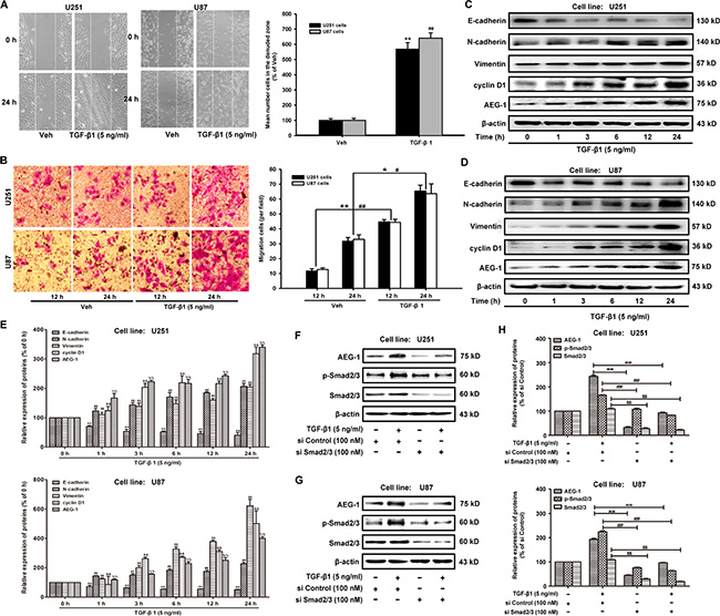 TGF-&#x03B2;1 increases AEG-1 expression and induces EMT and invasion in malignant glioma cells.