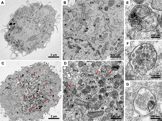 Figure 3:Transmission electron microscopy images of U87 malignant glioma cells following TGF-&#x03B2;1 treatment.
