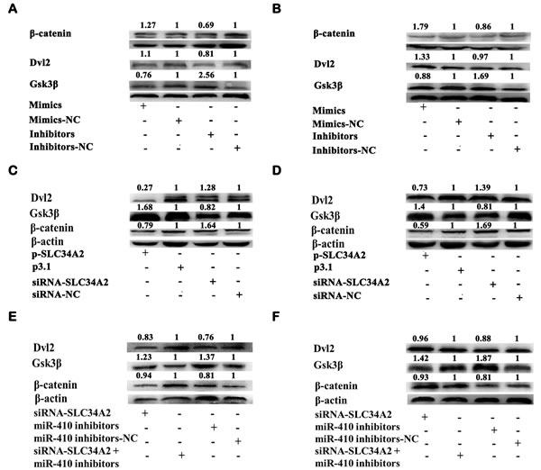 MiR-410 functioned by targeting SLC34A2 through Wnt/&#x3b2;-catenin pathway in NSCLC cells.
