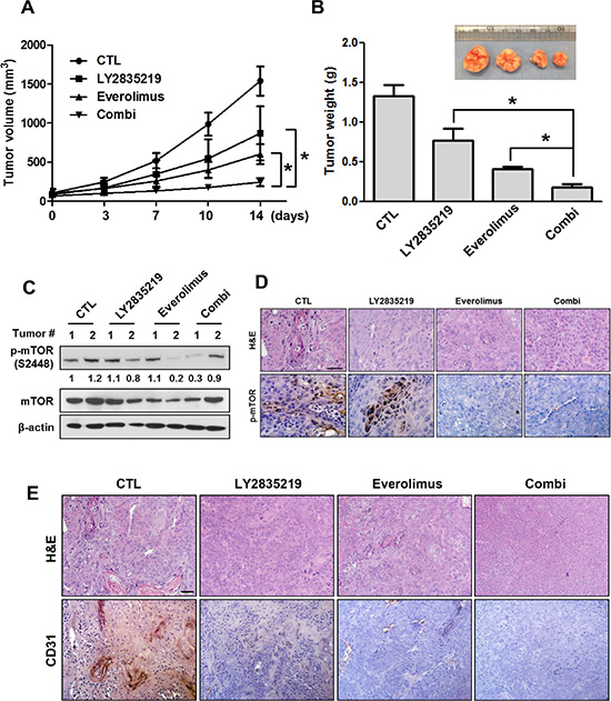 LY2835219 and mTOR inhibitor combination in HNSCC xenograft tumor model.