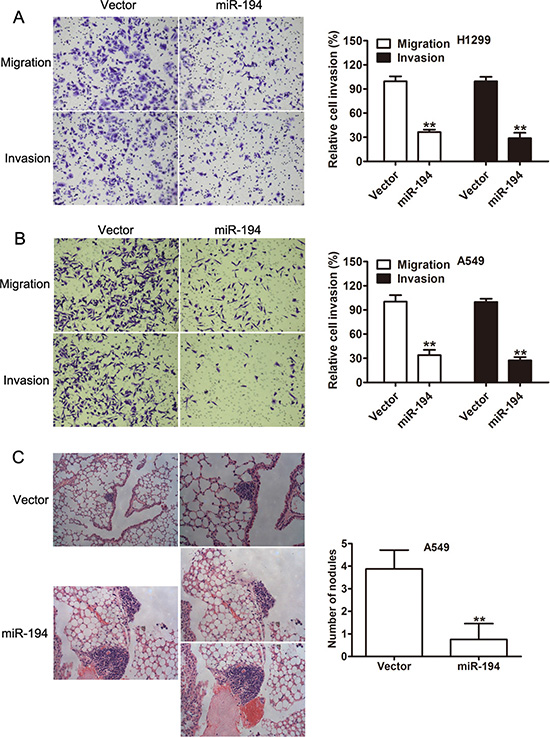 miR-194 inhibits the migratory, invasive, and metastatic capacities of NSCLC cells.