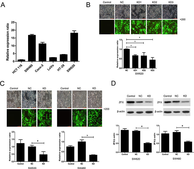 Analysis of ZFX expression and its lentivirus mediated shRNA knockdown.