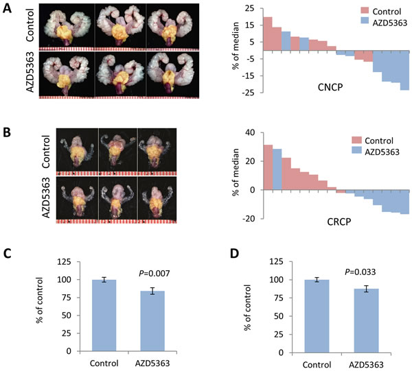 Chronic dosing of AZD5363 decreases tumor burden in