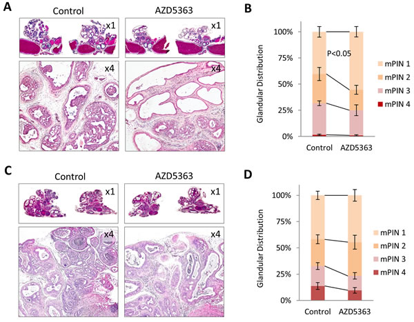 Treatment with AZD5363 reduces