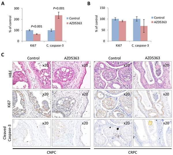 Effects of chronic AZD5363 treatment on tumor proliferation and apoptosis.