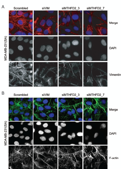 MTHFD2 knockdown disrupts vimentin network formation.