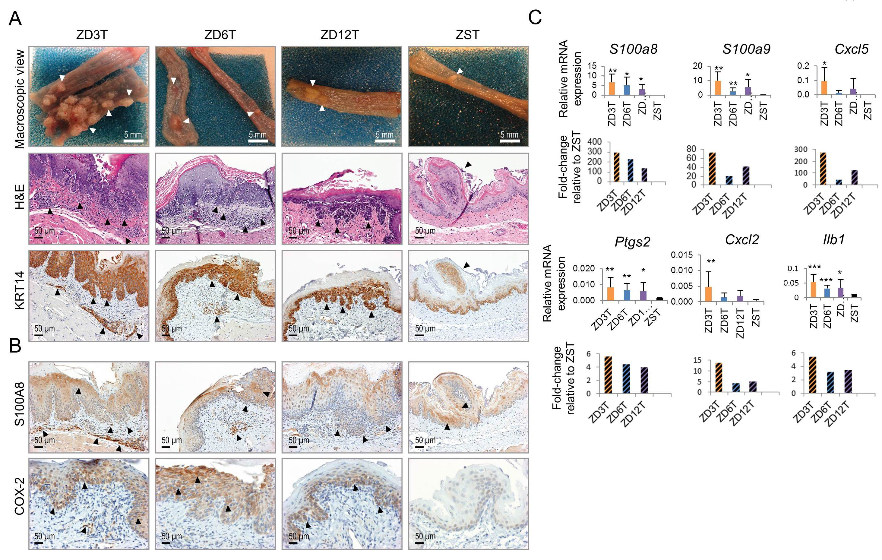 Esophageal tumor development in marked-ZD, moderate-ZD, and mild-ZD rats.