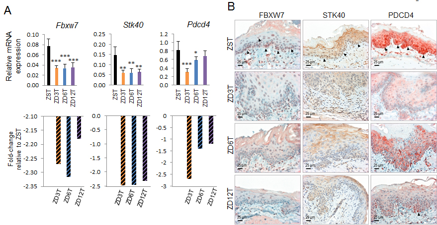 Analysis of esophageal expression of Fbxw7, Stk40, and Pdcd4 (respective tumor suppressor targets of miR-223, miR-31, and -21) in Zn-modulated rats at tumor endpoint.