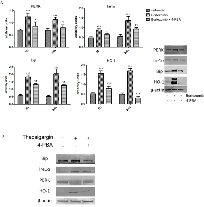 PERK, IRE1&#x03B1;, BiP and HO-1 protein levels in U266 cell cultures treated with BTZ (15 nM for 24h)