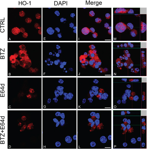 CLSM analysis of HO-1 localization in untreated U266 cell cultures (A, E, I, M) and following BTZ (15 nM for 24h) treatment alone (B, F, J, N) and/or in combination with E64d (20 &#x03BC;M) (C, G, K, O; and D, H, L, P).