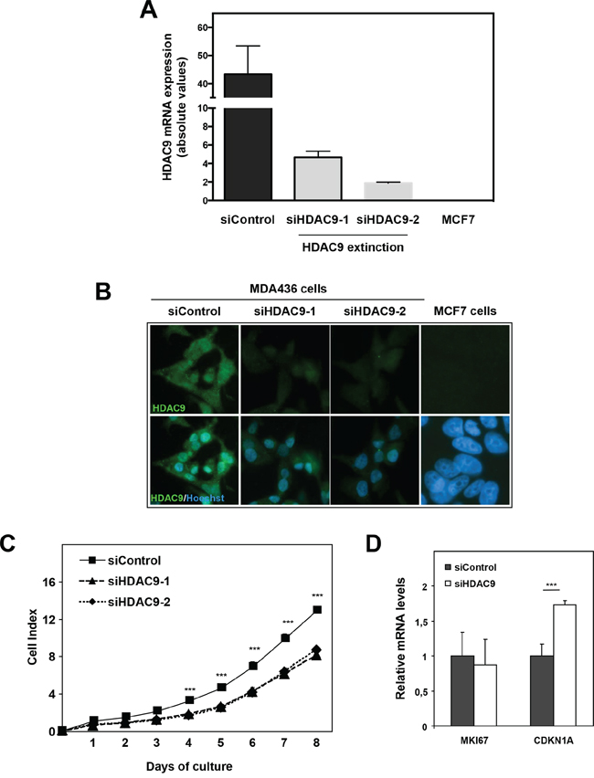 Effect of HDAC9 knock-down on breast cancer cell proliferation.