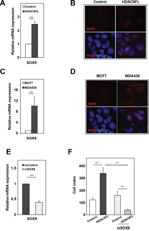 SOX9 is a target gene of HDAC9 in breast cancer cells.