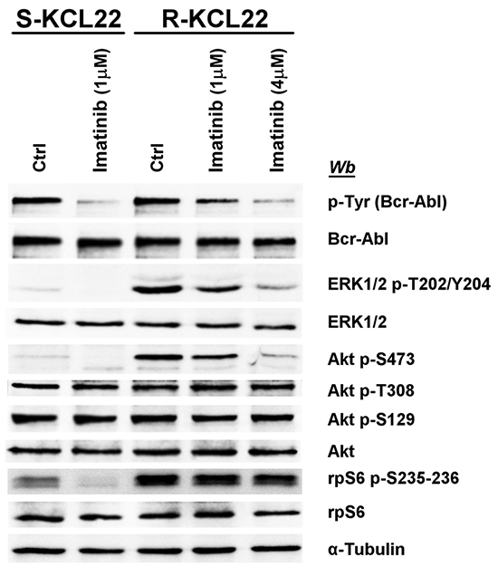 Effect of imatinib on MEK/ERK1/2 and PI3K/Akt/mTOR pathways in KCL22 cells.