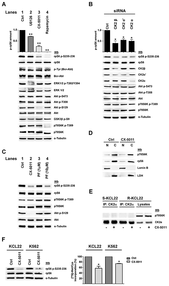 Effect of CK2 down-regulation by CX-5011 or siRNA on rpS6 phosphorylation and protein synthesis in imatinib-resistant CML cells.