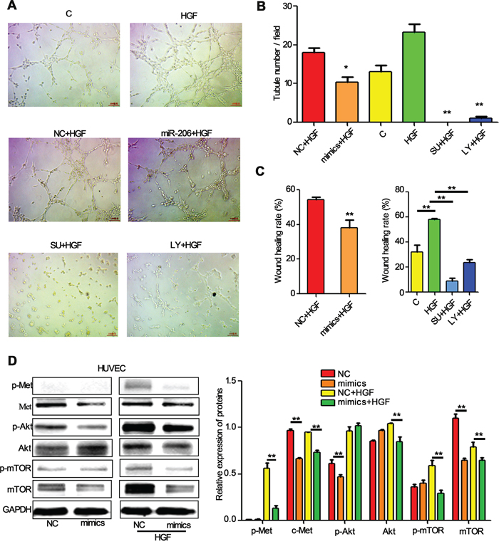 miR-206 suppresses the migration and tube formation of HUVEC cells.
