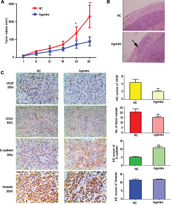 The effect of miR-206 on tumor growth, metastasis and angiogenesis and EMT in tumour xenografts.