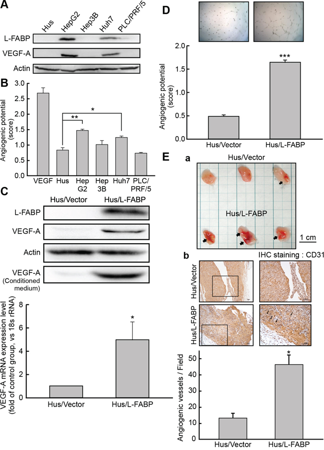 L-FABP promotes VEGF-A expression and angiogenic activity of liver cells.