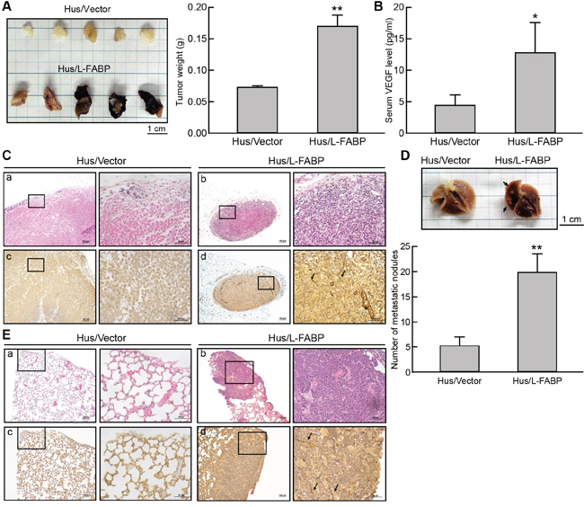 L-FABP promotes tumor growth and metastasis in vivo.