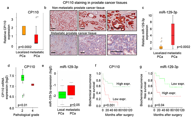CP110 is repressed by miR-129-3p and downregulated in metastatic PCa.