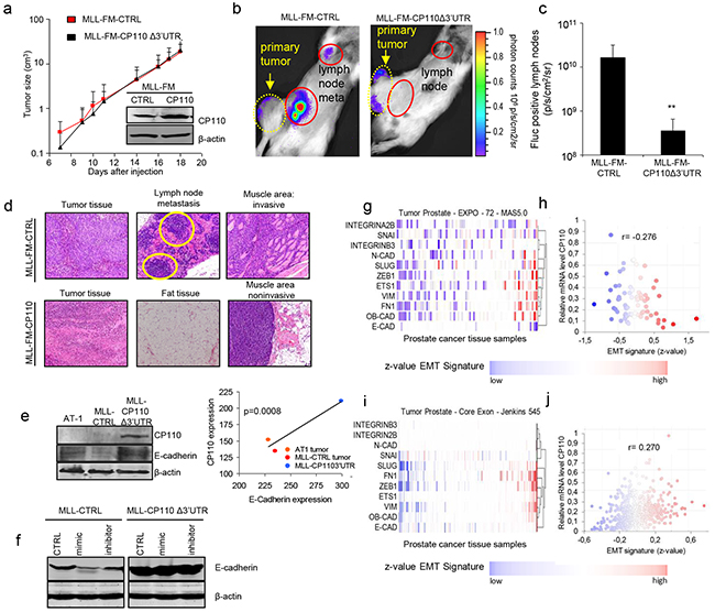 miR-129-3p and CP110 regulate cell metastasis.
