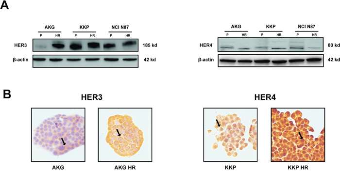 Characterization of resistant subclones: AKG HR, KKP HR and NCI N87 HR cells.
