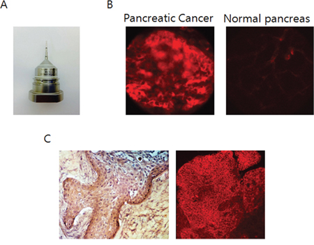 Ex-vivo microscopic imaging of an orthotopic pancreatic tumor labeled with fluorescent anti-IGF-1R antibody.