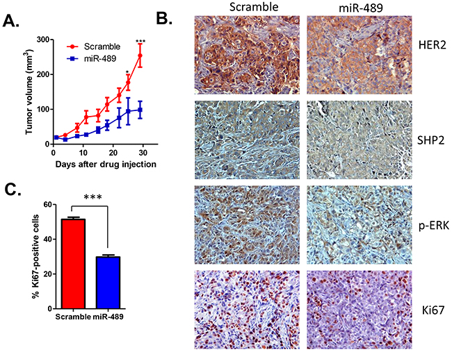 Overexpression of miR-489 inhibits tumor growth in vivo.