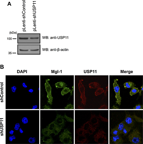 Knock down effect of USP11 on cancer cells.