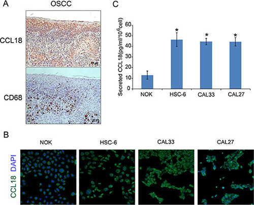 Secretion of CCL18 from OSCC tissues and cells.