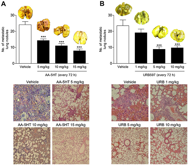 Impact of the FAAH inhibitors AA-5HT and URB597 on lung metastasis in nude mice.