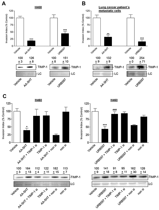 Effect of TIMP-1 knockdown on the anti-invasive and TIMP-1-upregulating action of FAAH inhibitors in other lung cancer cells.