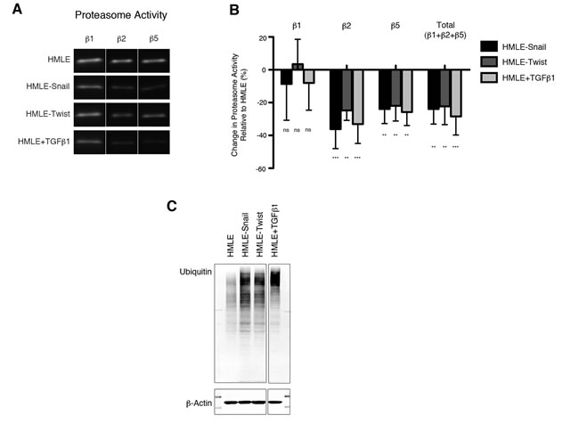 Downregulation of proteasome activity is associated with EMT.