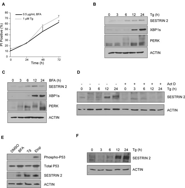 Induction of ER stress leads to upregulation of SESTRIN 2 expression independent of P53.