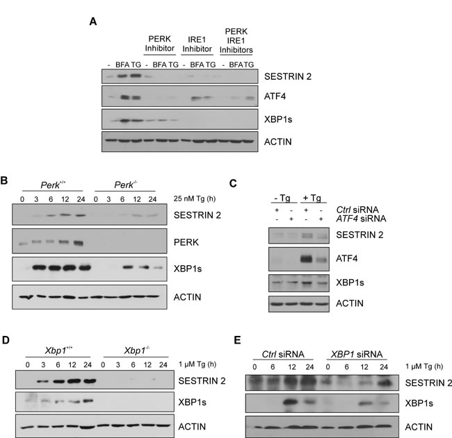 UPR pathways contribute to ER stress-induced enhancement of SESTRIN 2 expression.