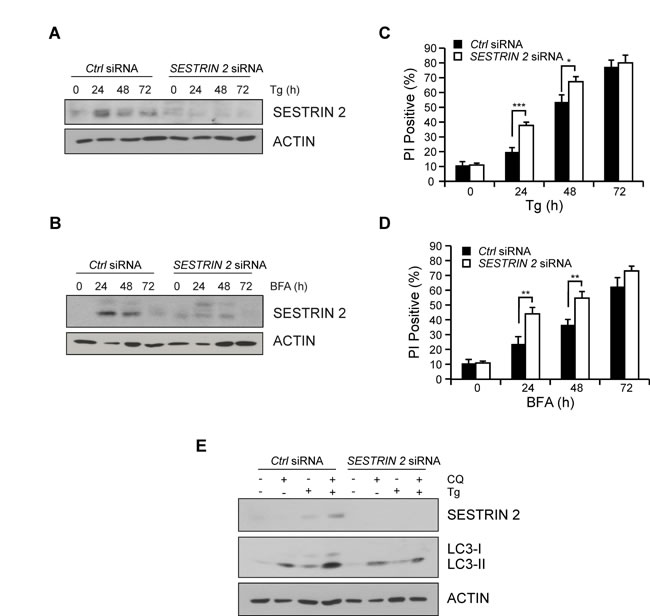 SESTRIN 2 knockdown inhibits ER stress-induced autophagy and enhances ER stress-induced cell death.
