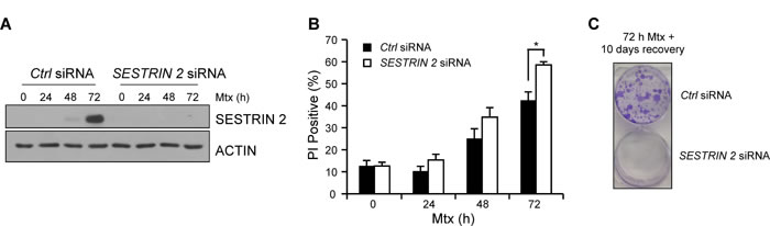 Knockdown of SESTRIN 2 enhances Methotrexate-induced death.