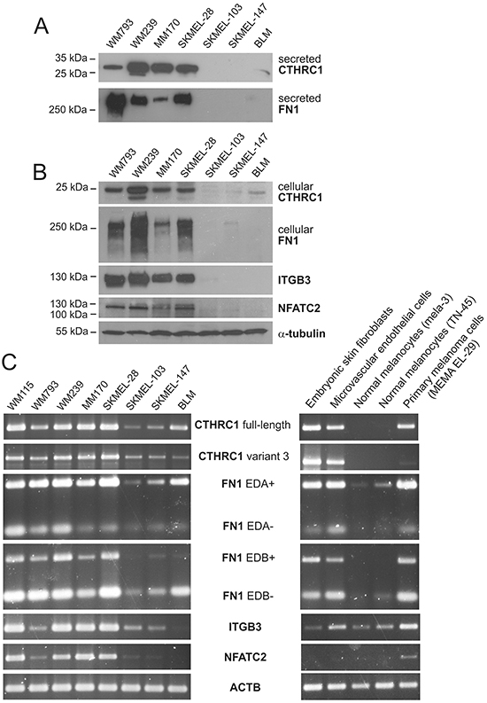 Expression of CTHRC1 and genes coordinately expressed with CTHRC1 in melanoma cell lines.